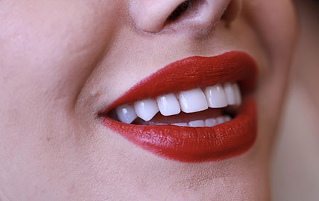 کامپوزیت ونیر