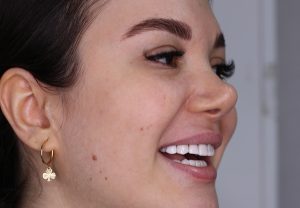 لمینت اهواز | دکتر رضا بهمن نژاد