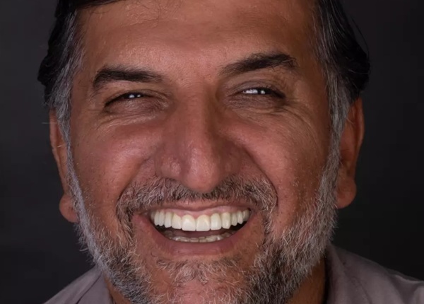 ایمپلنت اهواز | ایمپلنت دیجیتال اهواز | ایمپلنت فوری اهواز | دکتر رضا بهمن نژاد